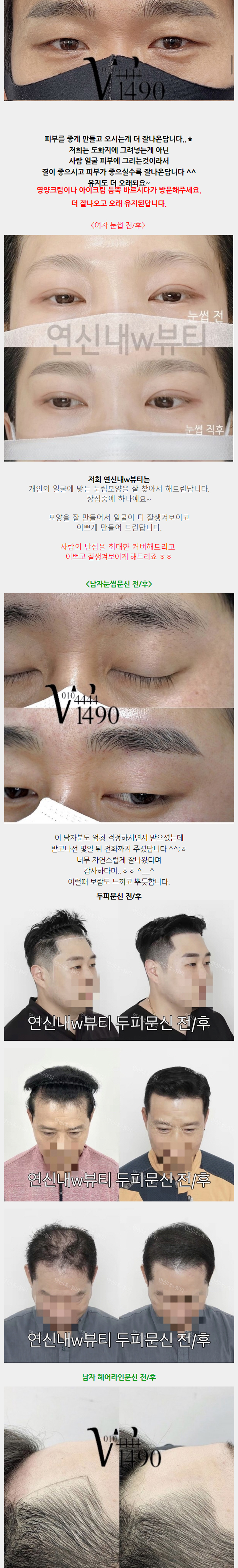 W뷰티_4_4