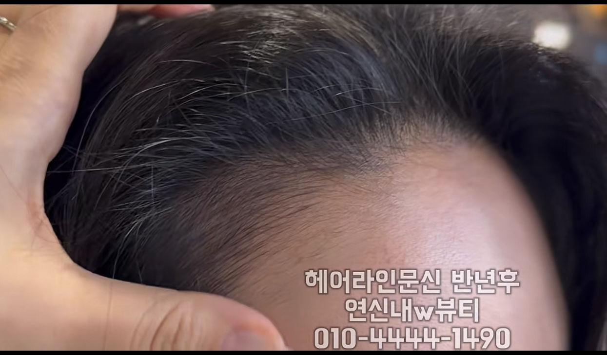 /user/w/wbeauty1490/editor/2511/8cfdb2acb72dd214a95a14a92db5904f_1762762258_4009.jpg 이미지크게보기