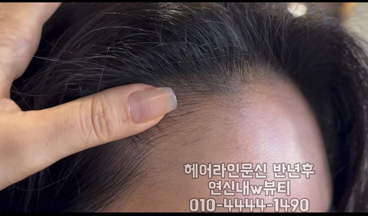 /user/w/wbeauty1490/editor/2511/8cfdb2acb72dd214a95a14a92db5904f_1762769392_131.jpg 이미지크게보기